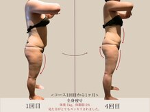 エル 麻布十番(LllL)/【痩身】1ヶ月ビフォアフ