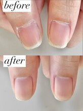 ニコワイズネイル(Nico Y's Nail)/【自爪育成コース】