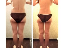 バービーホリック(barbie holic)/１６０コース