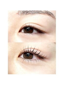 アンフィズム(annfism)/