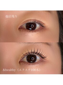 アネラ(anela)/&healthy