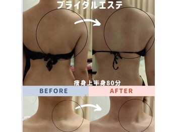 マールム(MALUM)/ブライダル　痩身