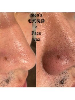 エトレ(ETOLE)/毛穴洗浄×フェイスwax