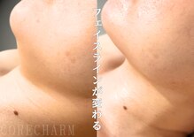 コア チャーム(CORE CHARM)