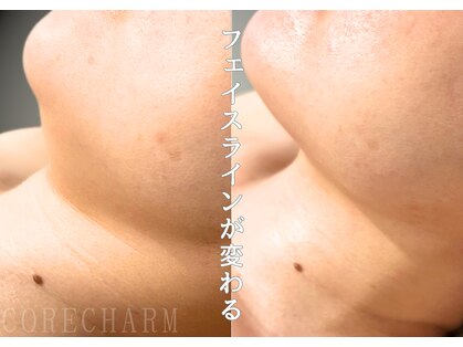 コア チャーム(CORE CHARM)の写真