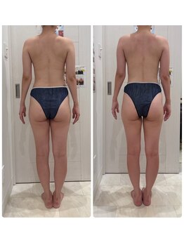 女神のデトックス 仙台店/痛みがないのにサイズダウン♪