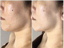 クレビア(CREBIA)/