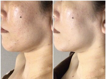 クレビア(CREBIA)/