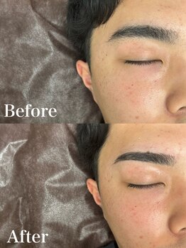 脱毛専門店 美的の写真/垢抜け眉はプロにお任せ！眉Waxで印象チェンジ【学割U24】￥2,200～♪ヒゲ脱毛セットも有！