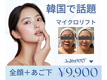 パルティール(PARTIR)