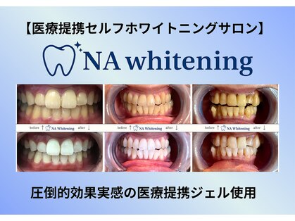 セルフホワイトニングサロン　NA ホワイトニング北谷店の写真