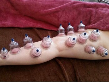 エミア(Emia)/カッピング