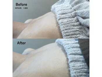 ウルル(ULuLu)/ビフォーアフター