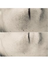 クラルス(clarus)/続ければ続けるほど美肌に変化！