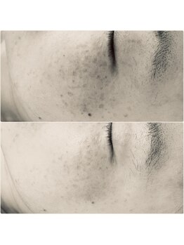 クラルス(clarus)/続ければ続けるほど美肌に変化!