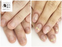 トイロ(toiro)/爪のコンプレックスも解消！