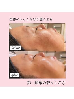 ディサイドロー(DECIDE L.A.W)/前顔のハリツヤup！