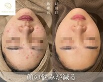 サロン ド レナ(Salon de LENA)