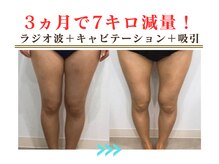 エスプラ 五反田店の雰囲気（太ももコース20分★ラジオ波&キャビ♪気になる部位を集中的に◎）