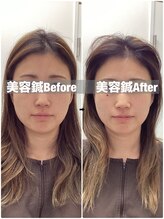 ハリサロンドオフ 堺東店(hari salon de off)/お客様before→after