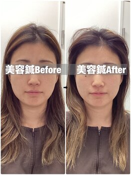ハリサロンドオフ 堺東店(hari salon de off)/お客様before→after