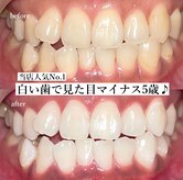 ラヴィス(RAVIS)