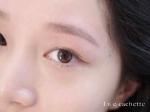 エンカシェット 代官山(En’e cachette)/【矯正美眉】ナチュラルで自然に