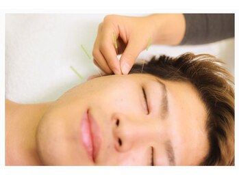 あさか美容整体院/【メンズ】3D美容鍼