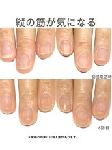 ブリエネイル/50代/爪の縦すじがきになる