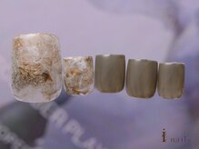 アイネイルズ 吉祥寺店(I nails)/初夏鉱物カーキフットネイル