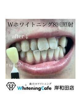 ホワイトニングカフェ 岸和田店(WhiteningCafe)/Wホワイトニング8回照射