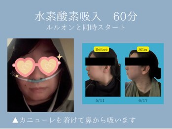 ヨサ パーク モモ(YOSA PARK MOMO)/《6》水素酸素吸入　60分