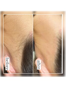 モンクラッシー(Mon classy)/うなじwax