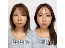 プリップ 中目黒(Pulip)/ビフォーアフター