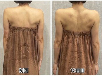 ロココ 四日市店(Rococo)/背中中心に骨格整えます!