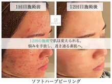 ベル 堀江(Belle)の雰囲気（お肌が変われば世界が変わる【お得な回数券で生まれ変われる】）