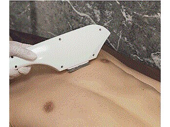 シンバ 南草津店(SIMBA)/【胸・腹脱毛】胸部