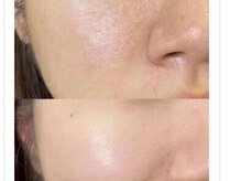 マリヴェリーテ(Mari verite)/毛穴/艶肌/フェイシャル