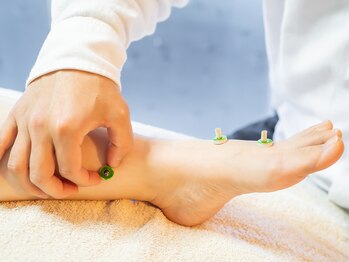 おかがわ鍼灸院/冷え体質の方にはお灸がおすすめ