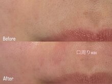 アイロンボーイ(IRONBOY)/艶肌お顔全体WAX