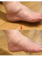 サロンアール(SALON R)/くるぶし・足の甲のむくみ改善