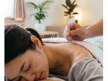 鍼灸治療院 麗月庵 新宿 代々木/施術のイメージ　[新宿/鍼灸]