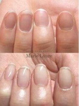 マリーロール 梅田店(Marie Laure)/自爪育成/深爪矯正/ネイルケア