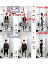 姫路なごみ整体院 なごみ鍼灸院/改善例（足痛みと肩と背中痛）