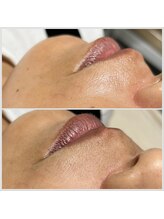 アドリー ラパン(ADRY./ Lapin)/フェイシャルワックス