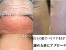 エイジングケア/剥けないハーブでしみしわ改善ヘッドマ付★¥15,000→9,800