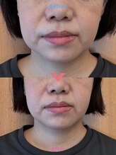 パーチェスガールズ 姪浜店(Pace-se Girls)/小顔矯正