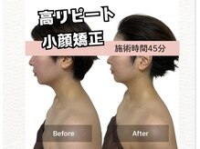 リノリー(rinory)の雰囲気（人気No.1小顔矯正！！）