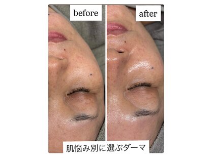 ユズドット(yuzu.)の写真