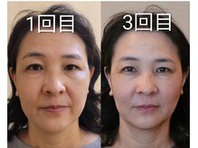 楓整骨院/続けるほど、美しく